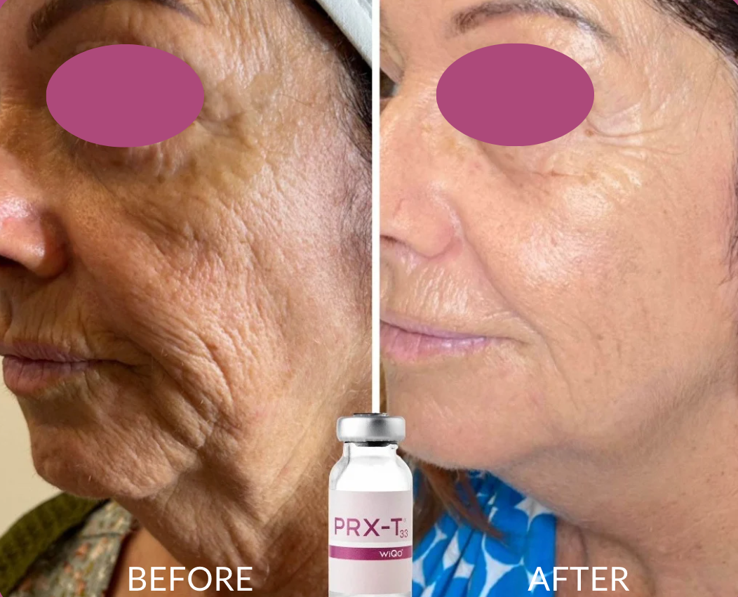 Glow Revive Pro Therapy