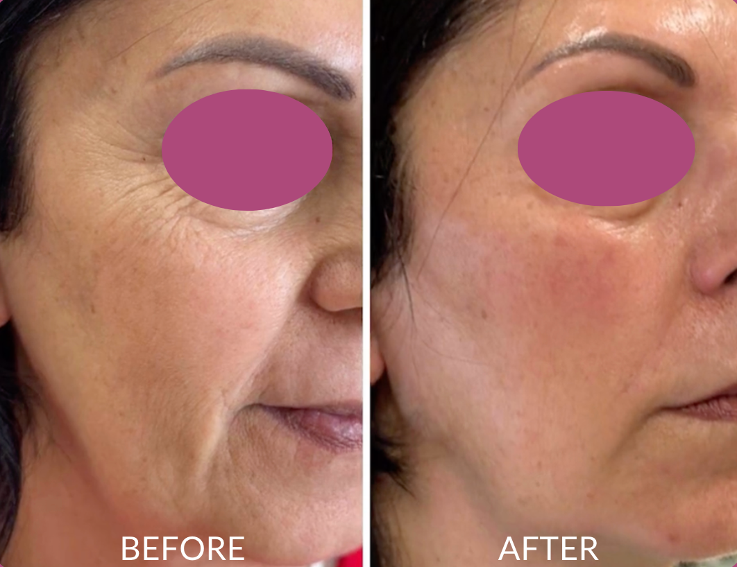 Glow Revive Pro Therapy